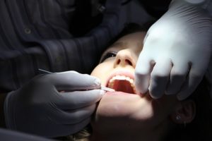 עוברים השתלות שיניים – עשרה דברים שחשוב לדעת לפני ההשתלה