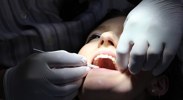 השתלות שיניים