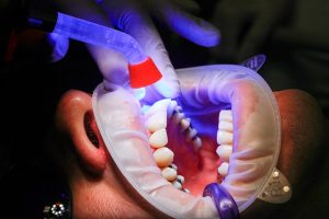 טיפולי שיניים רשלניים